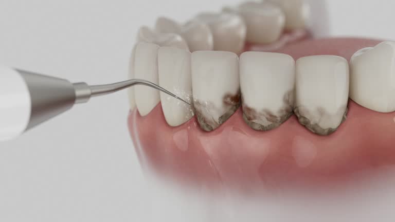 Trusted Teeth Cleaning And Checkup service in Portland, TX - Dentist Open Now